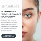 YAKER Hair Restoration Med Spa graphic 600X600 ... (Click to enlarge)