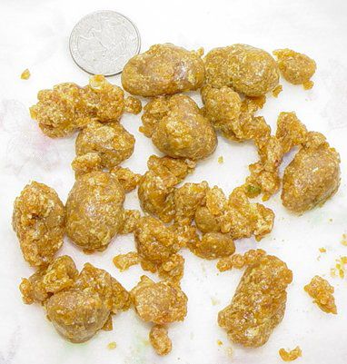 Click Here To See the NEXT image ( 5 ) (Results of my second Liver Flush ... cholesterol stones ... ) 