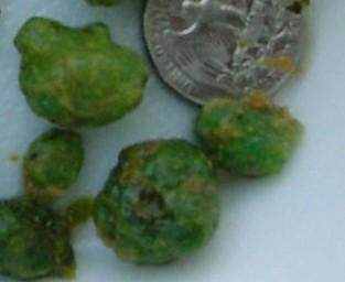 Click Here To See the NEXT image ( 2 ) (<br>flowerchild59: Stones I got on my 2nd liver flush) 