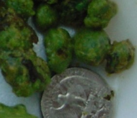 Click Here To See the NEXT image ( 3 ) (<br>flowerchild59: Stones I got on my 2nd liver flush) 