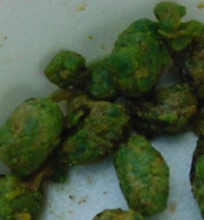 Click Here To See the NEXT image ( 4 ) (<br>flowerchild59: Stones I got on my 2nd liver flush) 