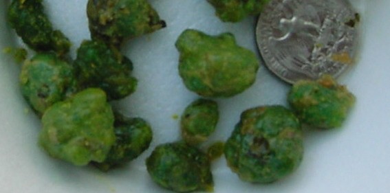 Click Here To See the NEXT image ( 5 ) (<br>flowerchild59: Stones I got on my 2nd liver flush) 