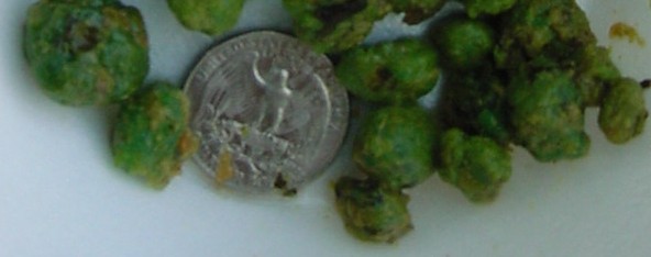 Click Here To See the NEXT image ( 6 ) (<br>flowerchild59: Stones I got on my 2nd liver flush) 