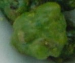 Click Here To See the NEXT image ( 0 ) (<br>flowerchild59: Stones I got on my 2nd liver flush) 