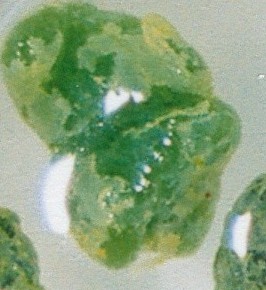 Click Here To See the NEXT image ( 8 ) (Rusfox: *Stones* I got on my 9th liver flush, after drinking dark red colored olive oil/grapefruit juice) 
