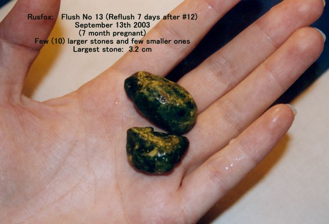 Click Here To See the NEXT image ( 3 ) (Rusfox: My photos of the *stones* I got on my 11th, 12th and 13th liver flush, while 5 and 7 months pregnant (Stones are not calcified)) 