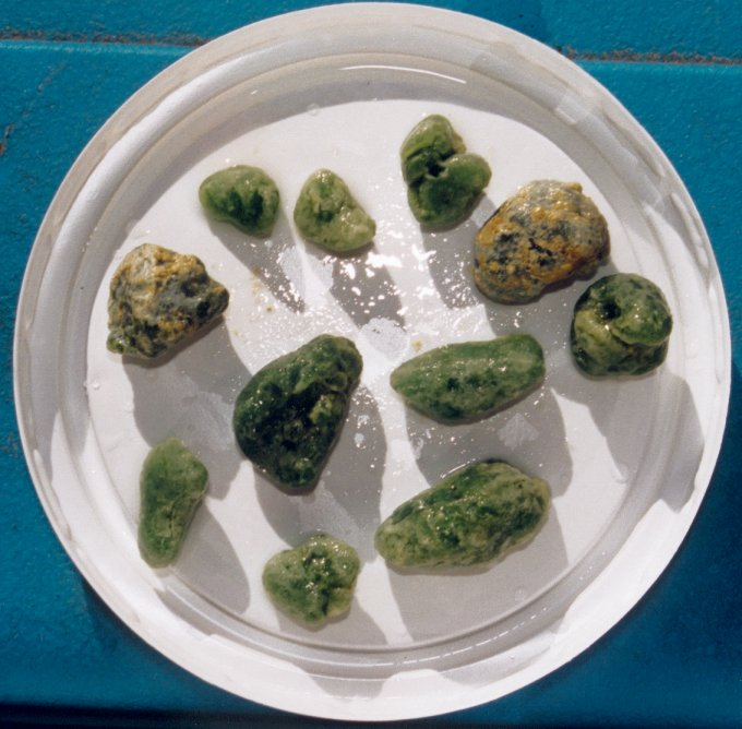 Click Here To See the NEXT image ( 22 ) (Rusfox: Photos of my liver flush *stones* that I expelled on my 14th liver flush, while breastfeeding a baby) 