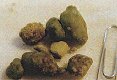 Click Here To See the NEXT image ( 0 ) (Liver Stones and Gallstones - Results of Liver Cleanse - Flush and Gallbladder Cleanse<br>Look at the bottom of this page to find links to different recipes for cleansing Liver & gallbladder) 