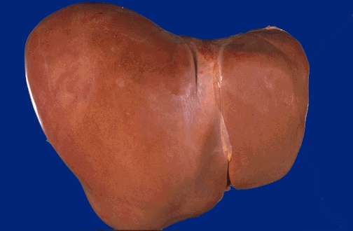 Click Here To See the NEXT image ( 11 ) (This is the external surface of a normal liver. The color is brown and the surface is smooth. A normal liver is about 1200 to 1600 grams.) 