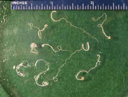 Click Here To See the NEXT image ( 4 ) ( Human Worms and other parasites ) 