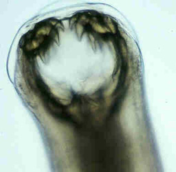 Click Here To See the NEXT image ( 5 ) ( Human Worms and other parasites ) 