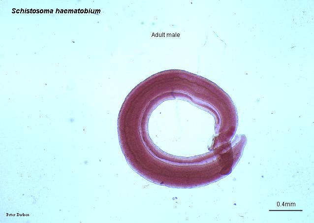 Click Here To See the NEXT image ( 10 ) ( Human Worms and other parasites ) 