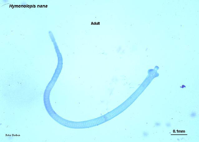 Click Here To See the NEXT image ( 13 ) ( Human Worms and other parasites ) 