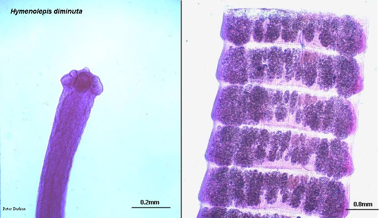 Click Here To See the NEXT image ( 14 ) ( Human Worms and other parasites ) 