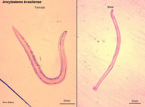 Click Here To See the NEXT image ( 15 ) ( Human Worms and other parasites ) 