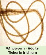 Click Here To See the NEXT image ( 18 ) ( Human Worms and other parasites ) 