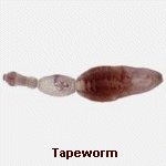 Click Here To See the NEXT image ( 19 ) ( Human Worms and other parasites ) 