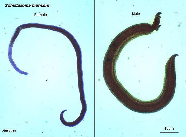 Click Here To See the NEXT image ( 27 ) ( Human Worms and other parasites ) 