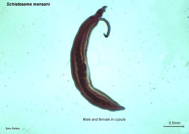 Click Here To See the NEXT image ( 29 ) ( Human Worms and other parasites ) 