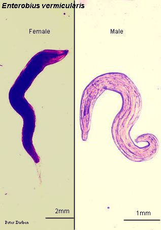 Click Here To See the NEXT image ( 37 ) ( Human Worms and other parasites ) 