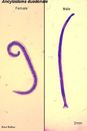 Click Here To See the NEXT image ( 38 ) ( Human Worms and other parasites ) 