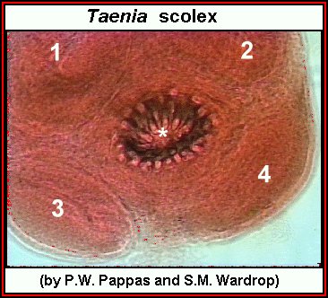 Click Here To See the NEXT image ( 43 ) ( Human Worms and other parasites ) 