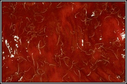 Click Here To See the NEXT image ( 46 ) ( Human Worms and other parasites ) 