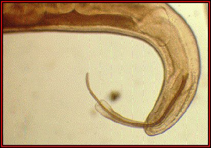 Click Here To See the NEXT image ( 47 ) ( Human Worms and other parasites ) 