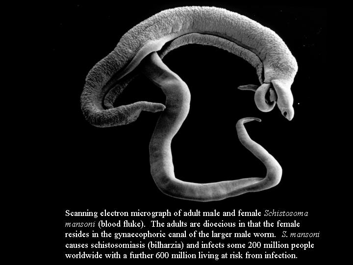 Click Here To See the NEXT image ( 49 ) ( Human Worms and other parasites ) 