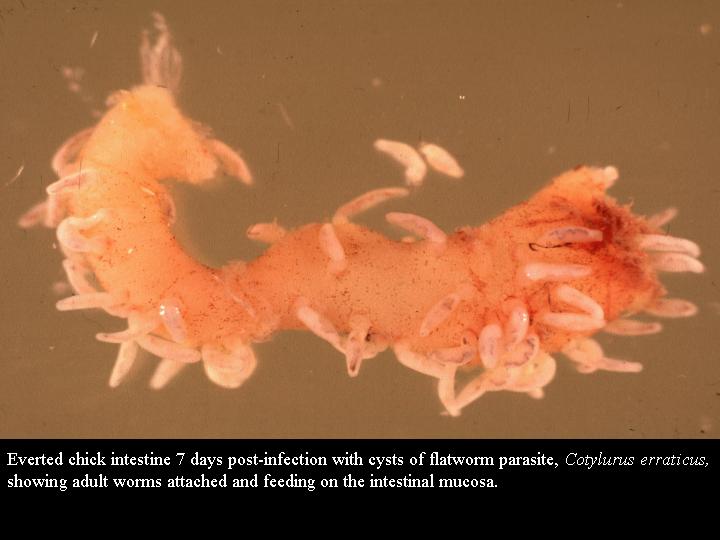 Click Here To See the NEXT image ( 52 ) ( Human Worms and other parasites ) 