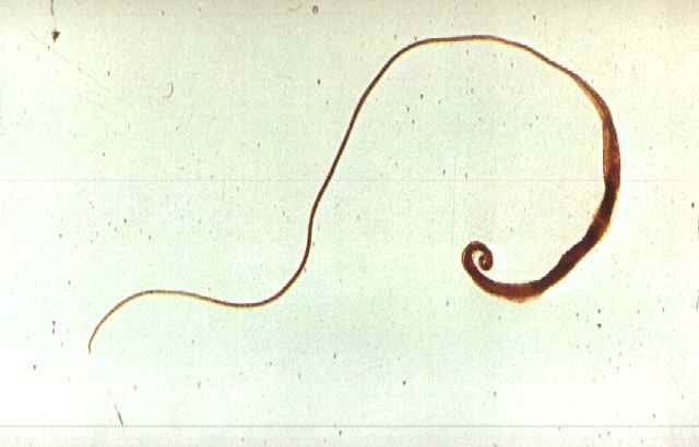 Click Here To See the NEXT image ( 61 ) ( Human Worms and other parasites ) 