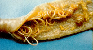 Click Here To See the NEXT image ( 6 ) ( Ascaris Lumbricoides - round worm - human intestinal parasites ) 