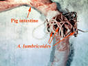 Click Here To See the NEXT image ( 8 ) ( Ascaris Lumbricoides - round worm - human intestinal parasites ) 