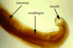 Click Here To See the NEXT image ( 11 ) ( Ascaris Lumbricoides - round worm - human intestinal parasites ) 