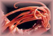 Click Here To See the NEXT image ( 12 ) ( Ascaris Lumbricoides - round worm - human intestinal parasites ) 