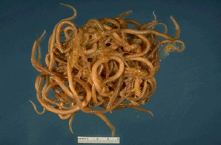 Click Here To See the NEXT image ( 15 ) ( Ascaris Lumbricoides - round worm - human intestinal parasites ) 