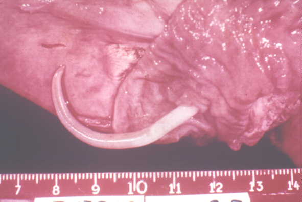 Click Here To See the NEXT image ( 23 ) ( Ascaris Lumbricoides - round worm - human intestinal parasites ) 