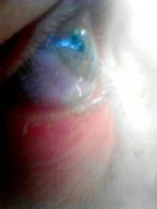 My Eye