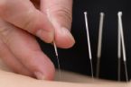 acupuncture