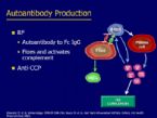 autoimmune diseasesx Rheumatoid arthritis synovial joint is infiltrate