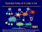 autoimmune diseasesx Rheumatoid arthritis synovial joint is infiltrate2