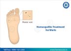 homeopathy treatment for warts ... (Click to enlarge)