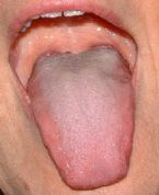 tongue9 ... (Click to enlarge)