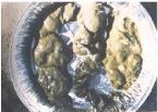 Mucoid Plaque. Photo from Dr. Bernard Jensen's  Bowel Management Book