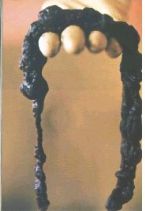 Mucoid Plaque. Photo from Dr. Bernard Jensen's  Bowel Management Book