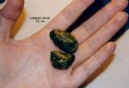 Longest Gallstone Stone 3 2 ... (Click to enlarge)