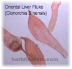 Liver Flush Results fluke1 ... (Click to enlarge)