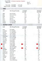 Liver Flush Results by kreeson