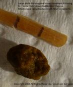 Stone from first liver flush.