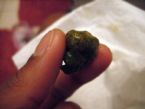 gallstone? liverstone? whoa! ... (Click to enlarge)